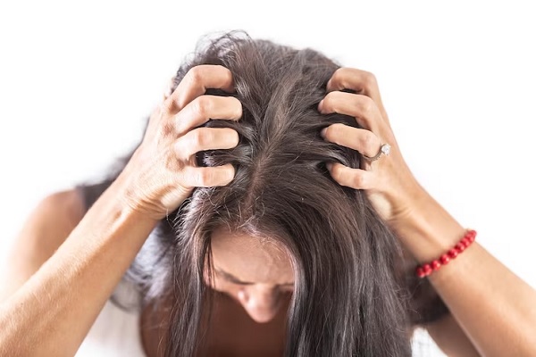 Alteraciones del cuero cabelludo - mujer con un fuerte comezon en el cuero cabelludo