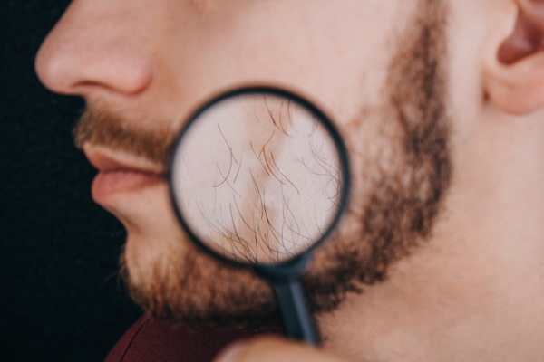 Injerto de barba - Hombre usando una lupa para observar el vello facial que comienza a crecer luego del implante de barba