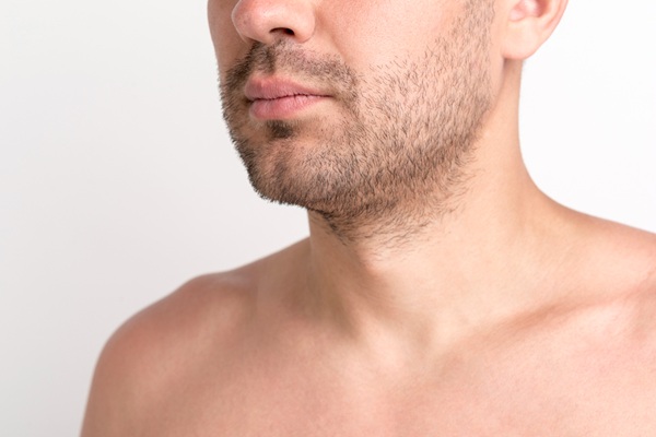 Injerto de barba - Vista de perfil de un hombre con barba corta que lo hace lucir atractivo y masculino