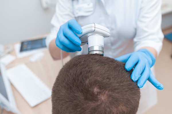 Tricoscopia para diagnóstico de alopecia