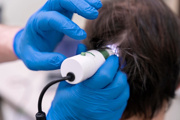 Láser de baja potencia - Tricólogo usando un laser de baja potencia en el cuero cabelludo de un hombre para estimular el crecimiento del cabello