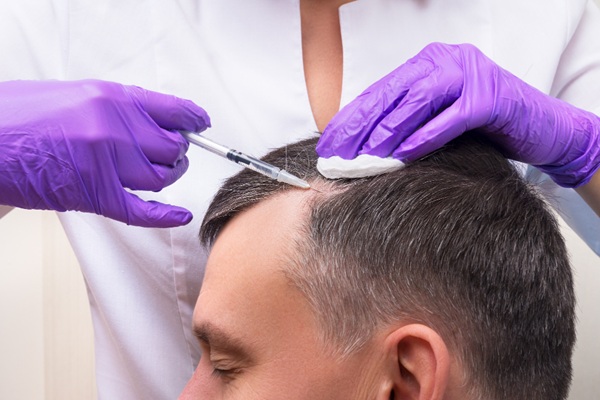 Tratamiento capilar - Hombre con pérdida de cabello recibiendo una inyección para hacer crecer el pelo como parte de los tratamientos capilares