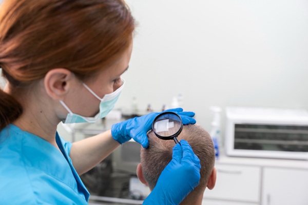 Tratamiento capilar - Doctora usando una lupa para evaluar el cuero cabelludo de un hombre con pérdida de pelo en la coronilla