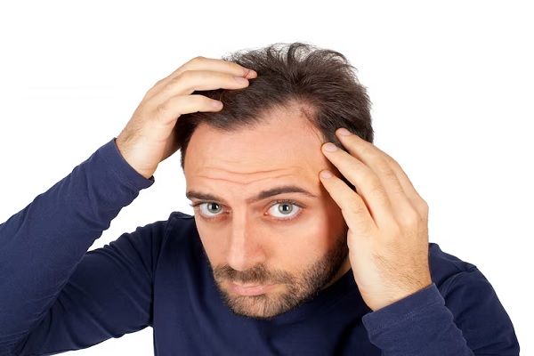 cabello grasoso