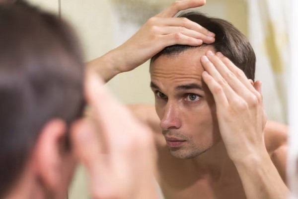 pelo después de una anemia