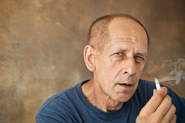 Tabaco y Alopecia