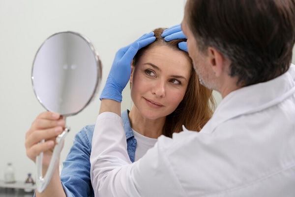 alopecia frontal fibrosante