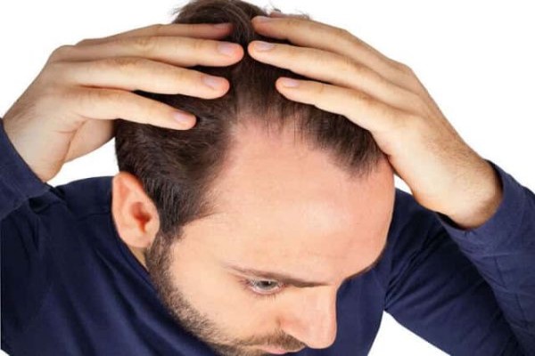 pastillas para la caída del pelo