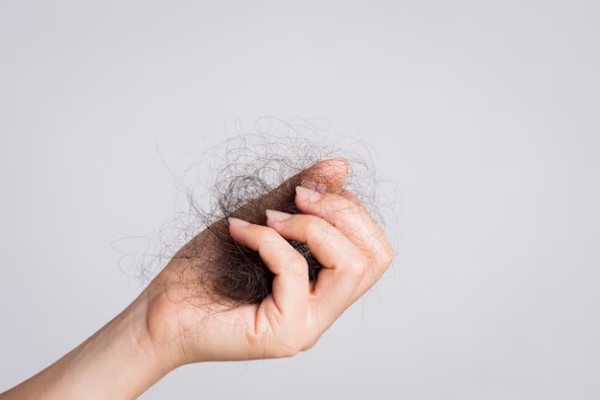 Cómo evitar la caída del pelo