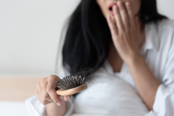 tipos de alopecia en mujer