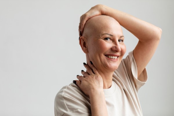 La calvicie en cifras - mujer mayor sufriendo alopecia por quimioterapia