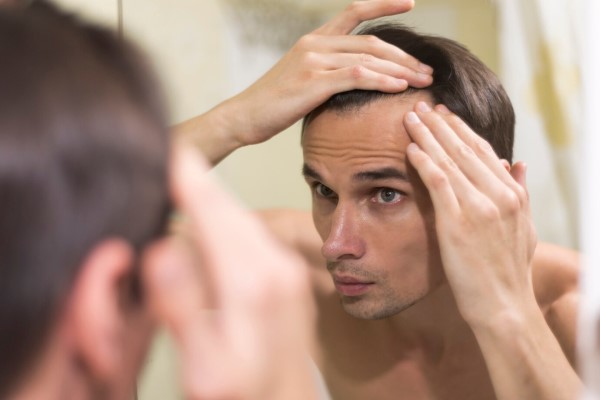 desarrollar alopecia - hombre frente al espejo preocupado por las entradas