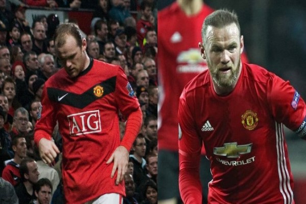 trasplante capilar en deportistas famosos - Wayne Rooney