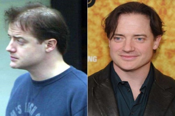 Brendan Fraser