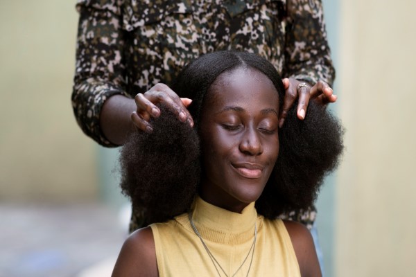 mujer africana con problemas de alopecia por tracción