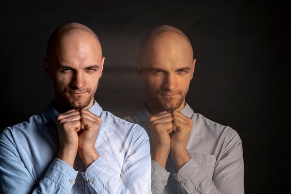 Consecuencias psicológicas de la alopecia- Hombre con problemas psicologicos causados por su perdida de pelo