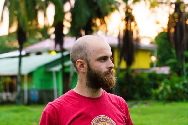 cura para la calvicie - hombre joven con graves problemas de alopecia