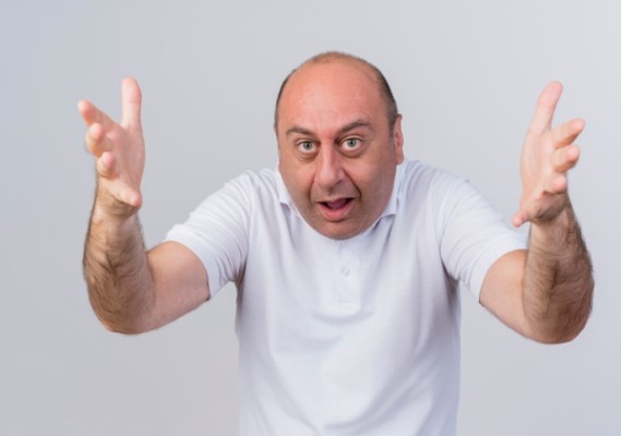 cura para la calvicie - hombre adulto con problemas de alopecia androgénica