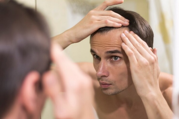 cae el pelo- Hombre mirando en el espejo sus entradas