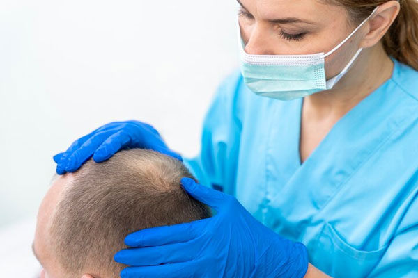 Dermatóloga examina el cuero cabelludo de un paciente con problemas de calvicie