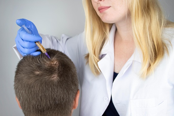 Implante capilar células madre - Médico tricólogo realizando un tratamiento de implante capilar con celulas madre a un hombre con alopecia en la coronilla