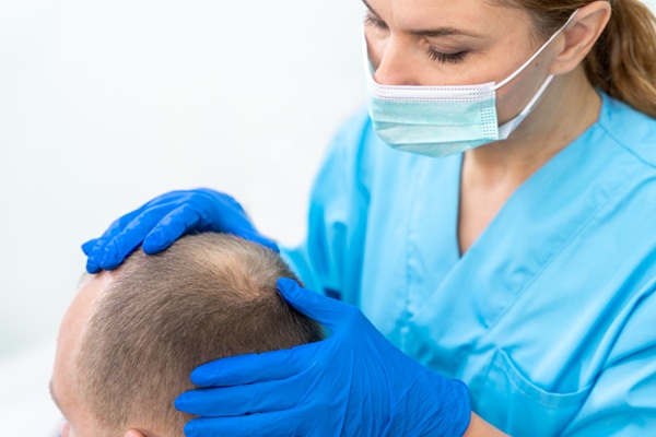 Injerto de cabello costo - Médico capilar observando el cuero cabelludo de un hombre con alopecia en la coronilla para determinar el implante capilar adecuado