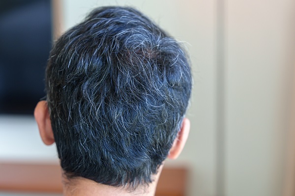 canas prematuras, parte de atrás de la cabeza de un hombre con el cabello canoso