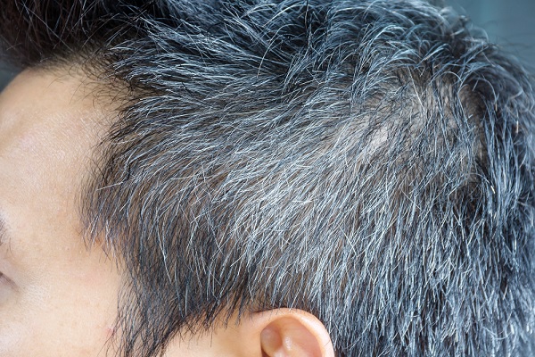 canas prematuras, hombre de perfil con el cabello gris