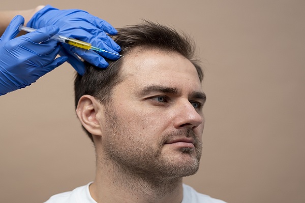 trasplante de cabello, hombre realizándose un procedimiento capilar de manos de un especialista