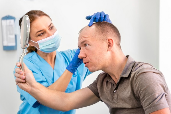 mejor clínica de trasplante capilar - tricóloga mide con sus dedos la apertura de las entrada del hombre, para determinar cuantos folículos se necesitan para el procedimiento
